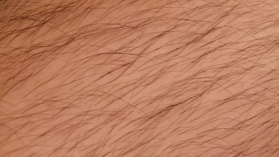 【画像】俺がAGA治療薬の副作用で全身毛だらけになっている件。